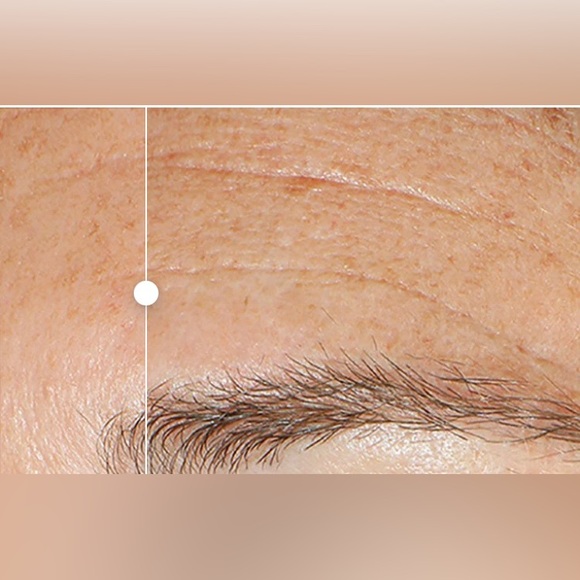 Murad Replenishing Multi-Acid Peel - Picture 3 of 12